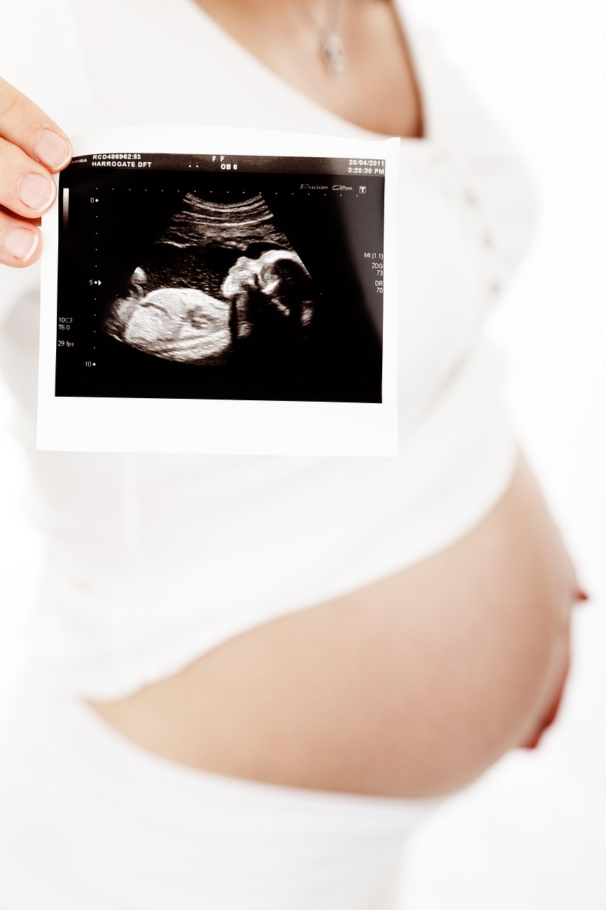 women showing baby bump and ultrasound test report